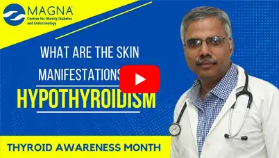 Skin Manifestations of Hypothyroidism | Thyroid Awareness Month |